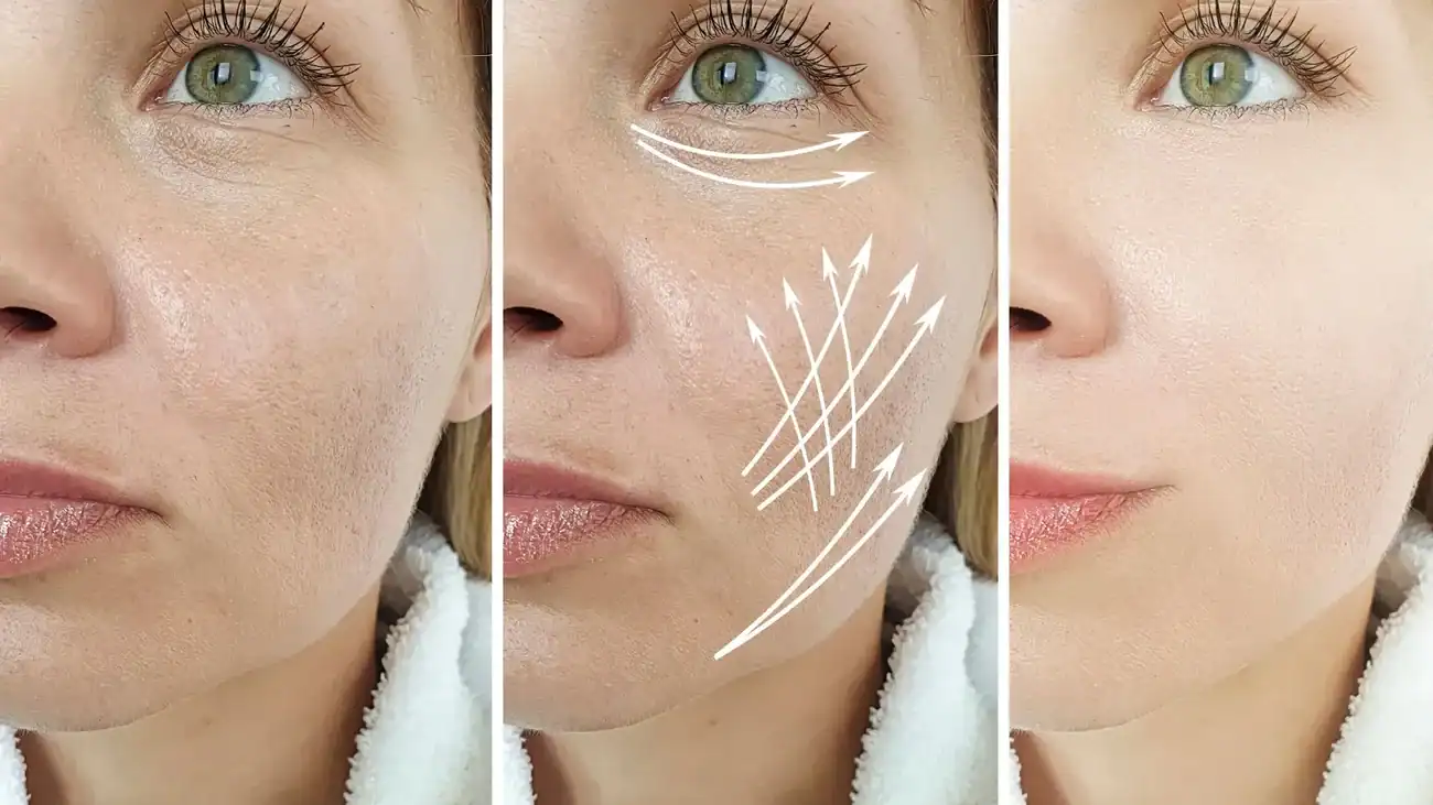 Can One Treatment Really Tackle More Than One Skin Concern Hereford?
