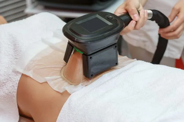 Image of person having fat freezing treatment to help weight gain Hereford