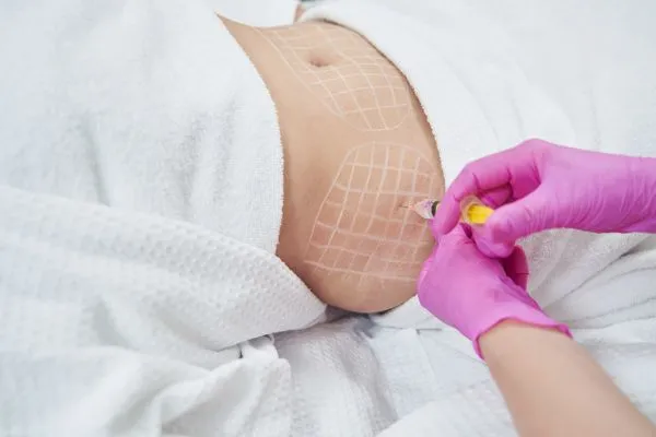 image of fat dissolving injections on love handles to help combat weight gain Hereford
