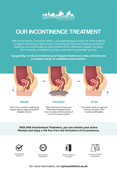 image to show how EMS treatment works for female urinary incontinence Hereford