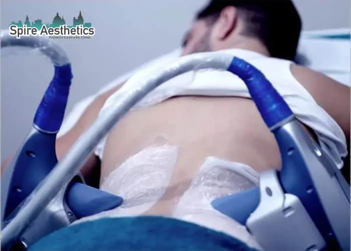 Man having fat freezing treatment done on love handles before a competitions Hereford to create a sculpted look.