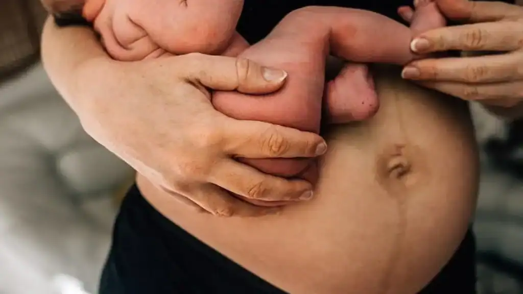 Why Is My Stomach Still Big After Pregnancy Hereford?